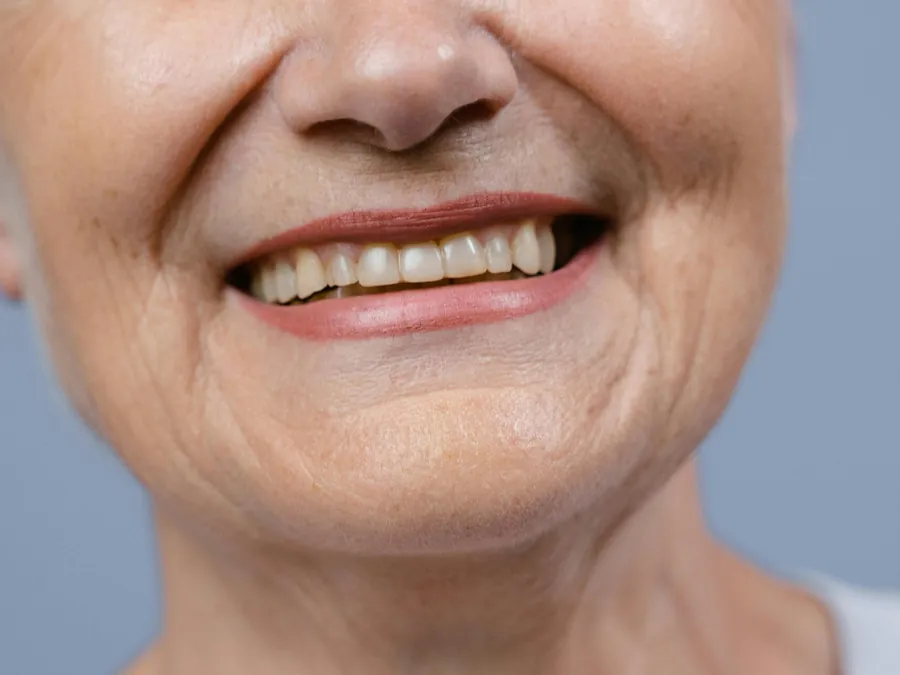 Sourire naturel d'une patiente après réhabilitation dentaire