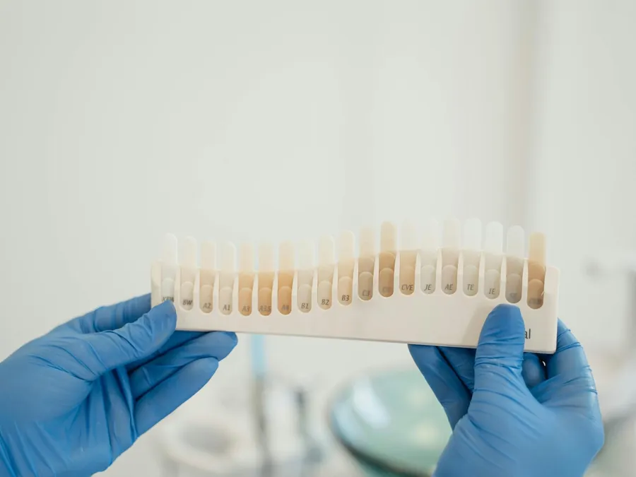 Teintier utilisé pour choisir la couleur des dents lors d'un soin esthétique